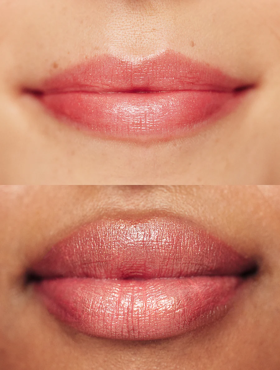 Baby Rose Gold 101 Ointment - Image 6